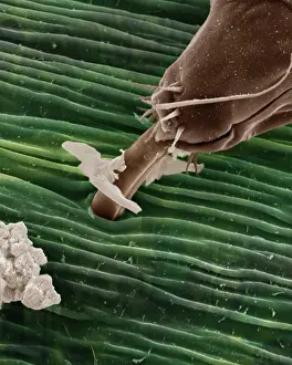 Aphis: Scanning Electron Micrograph (SEM): Black Aphid