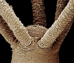 Hydra: Scanning Electron Micrograph (SEM): close up of