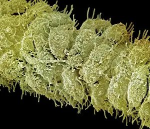 Hydra: Scanning Electron Micrograph (SEM): close up of