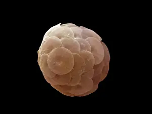 Calcareous: Scanning Electron Micrograph (SEM): Coccolithophore