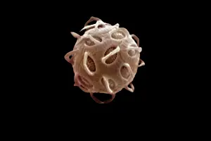 Electron: Scanning Electron Micrograph (SEM): Coccolithophore