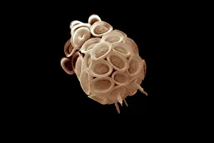 Electron: Scanning Electron Micrograph (SEM): Coccolithophore