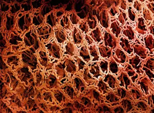 Intestinal: Scanning Electron Micrograph (SEM): Coloured scanning