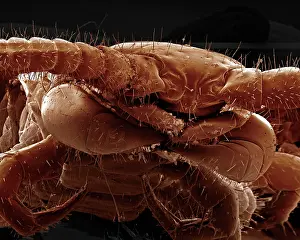 Centipedes: Scanning Electron Micrograph (SEM): Common Centipede