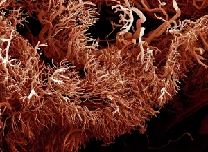 Micro: Scanning Electron Micrograph (SEM): a corrosion