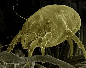 Mites: Scanning Electron Micrograph (SEM) Dust Mite