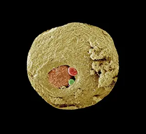 Cells: Scanning Electron Micrograph (SEM): Early human