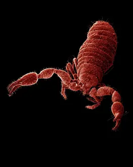Scorpions: Scanning Electron Micrograph (SEM): False Scorpion