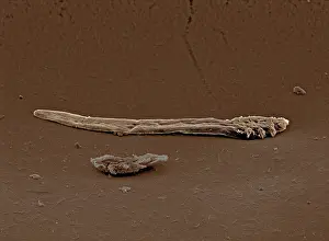 Mites: Scanning Electron Micrograph (SEM): Follicle Mite