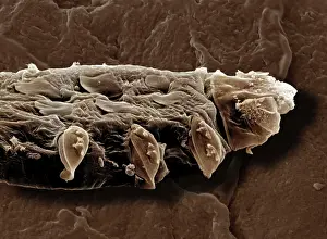 Mites: Scanning Electron Micrograph (SEM): Follicle Mite