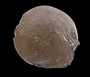 Electron: Scanning Electron Micrograph (SEM): Foraminifera