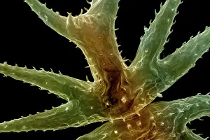Scanning: Scanning Electron Micrograph (SEM): Freshwater Desmid