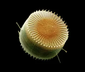 Diatom: Scanning Electron Micrograph (SEM): Freshwater Diatom