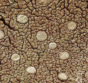 Papillae: Scanning Electron Micrograph (SEM): Frog tongue
