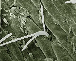 Fusarium: Scanning Electron Micrograph (SEM): Fusarium