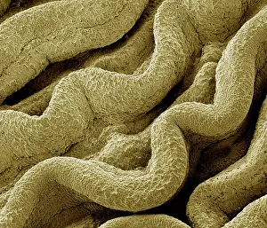 Tubes: Scanning Electron Micrograph (SEM): Human Fallopian tube