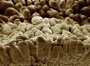 Cells: Scanning Electron Micrograph (SEM): human intestine