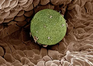 Scanning: Scanning Electron Micrograph (SEM); Human Ovum in
