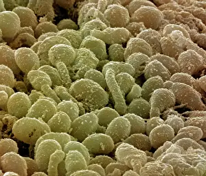 Cells: Scanning Electron Micrograph (SEM): Human Retina