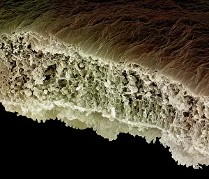 Cells: Scanning Electron Micrograph (SEM): Human Retina