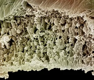 Cells: Scanning Electron Micrograph (SEM): Human Retina