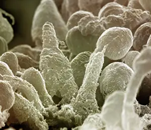 Cells: Scanning Electron Micrograph (SEM): Human Retina