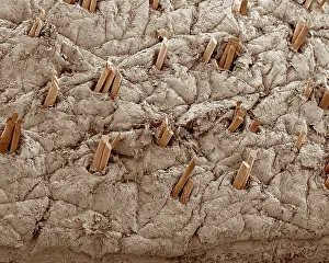 Cells: Scanning Electron Micrograph (SEM): Human Skin