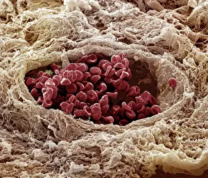 Scanning: Scanning Electron Micrograph (SEM): Human skin section