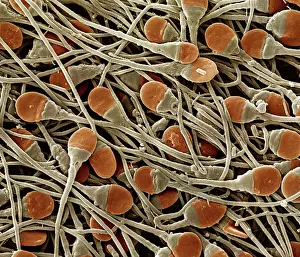 Sperm: Scanning Electron Micrograph (SEM): human sperm