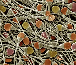 Sperm: Scanning Electron Micrograph (SEM): human sperm