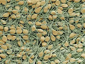 Sperm: Scanning Electron Micrograph (SEM); Human sperm cells