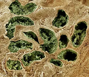Sperm: Scanning Electron Micrograph (SEM): Human testis