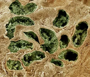 Micro: Scanning Electron Micrograph (SEM): Human testis