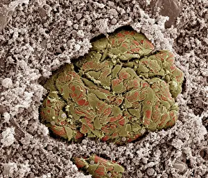 Micro: Scanning electron micrograph (SEM) of Kidney glomerulus