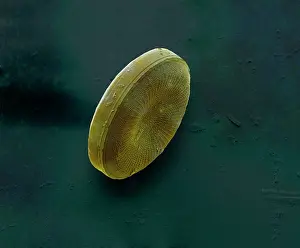Diatom: Scanning Electron Micrograph (SEM): Marine Diatom