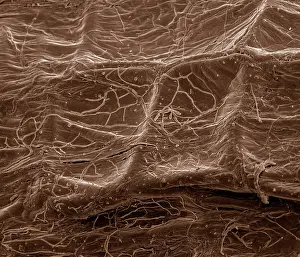 Mycorrhiza: Scanning Electron Micrograph (SEM): Mycorrhiza
