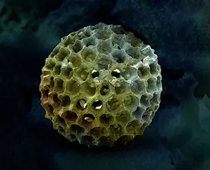 Zooplankton: Scanning Electron Micrograph (SEM): Spumellarian Radiolaria