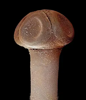 Tapeworm: Scanning Electron Micrograph (SEM): Tapeworm from