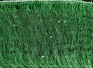 Yews: Scanning Electron micrograph (SEM): Yew Leaf