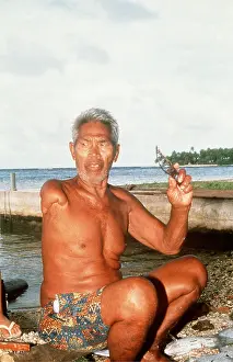 Attack: Shark attack victim - arm removed by shark