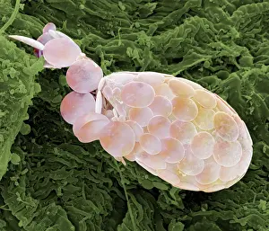 Microscope: Shelled Amoeba