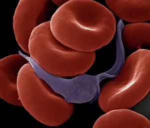 Cells: Sleeping Sickness Parasite in red blood cells