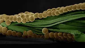 Microscope: Spectacle Moth - eggs