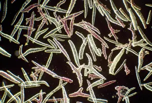 Sponges: Sponge Spicules - microscopic, x4 magnification