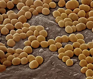 Aureus: Staphylococcus aureus bacteria