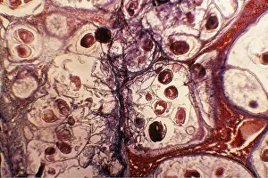 Worms: TAPE WORM - X 20 magnification
