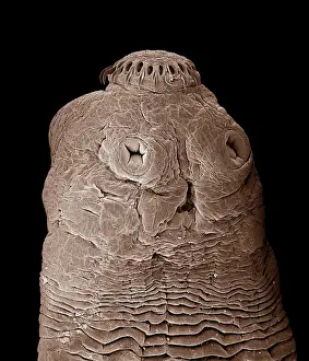 Micro: Tapeworm