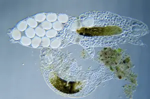 Largest: Tardigrade (Pseudobiotus megalonyx) microscopic