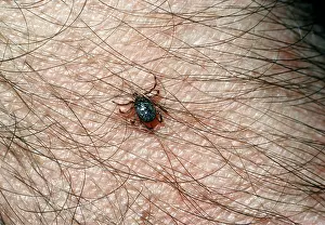 Ticks: TICK - on human flesh