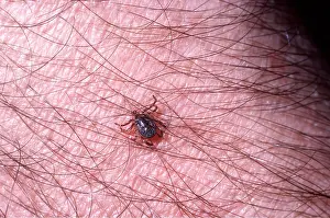 Tick: TICK on human skin - Close-up